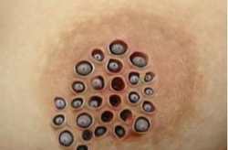 莲蓬手指恶心图,密集恐惧症与网络恶搞的交织